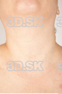 Neck texture of Ada 0001